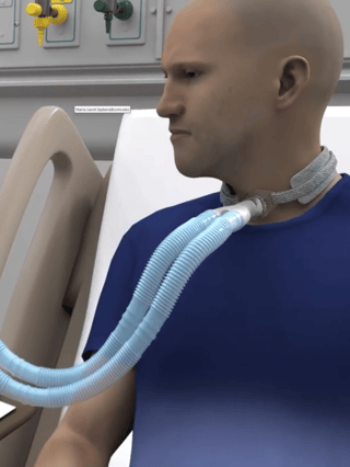 a visualization of a man in a hospital bed with a tracheostomy tube